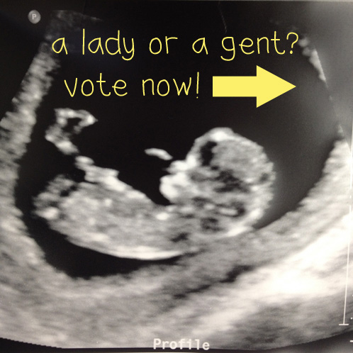 Vote for Boy or Girl!